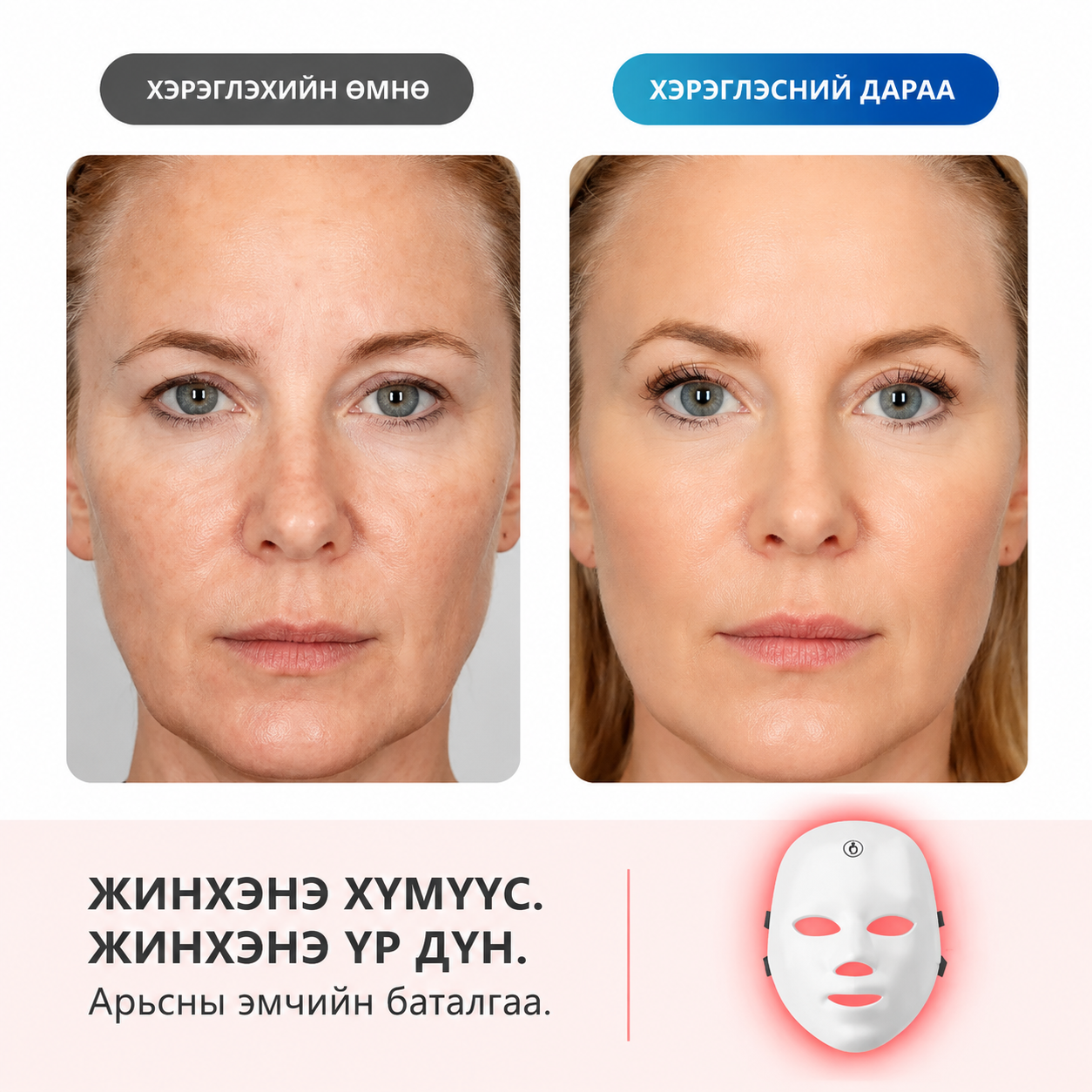 ENX Гэрлийн эмчилгээний маск