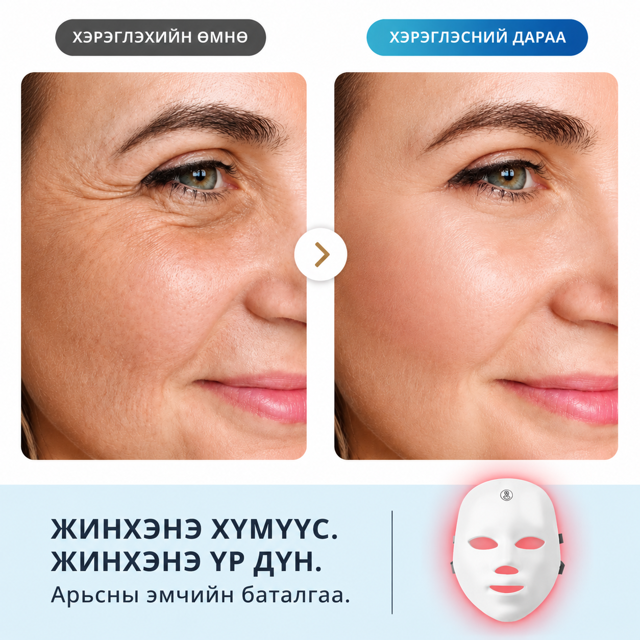 ENX Гэрлийн эмчилгээний маск